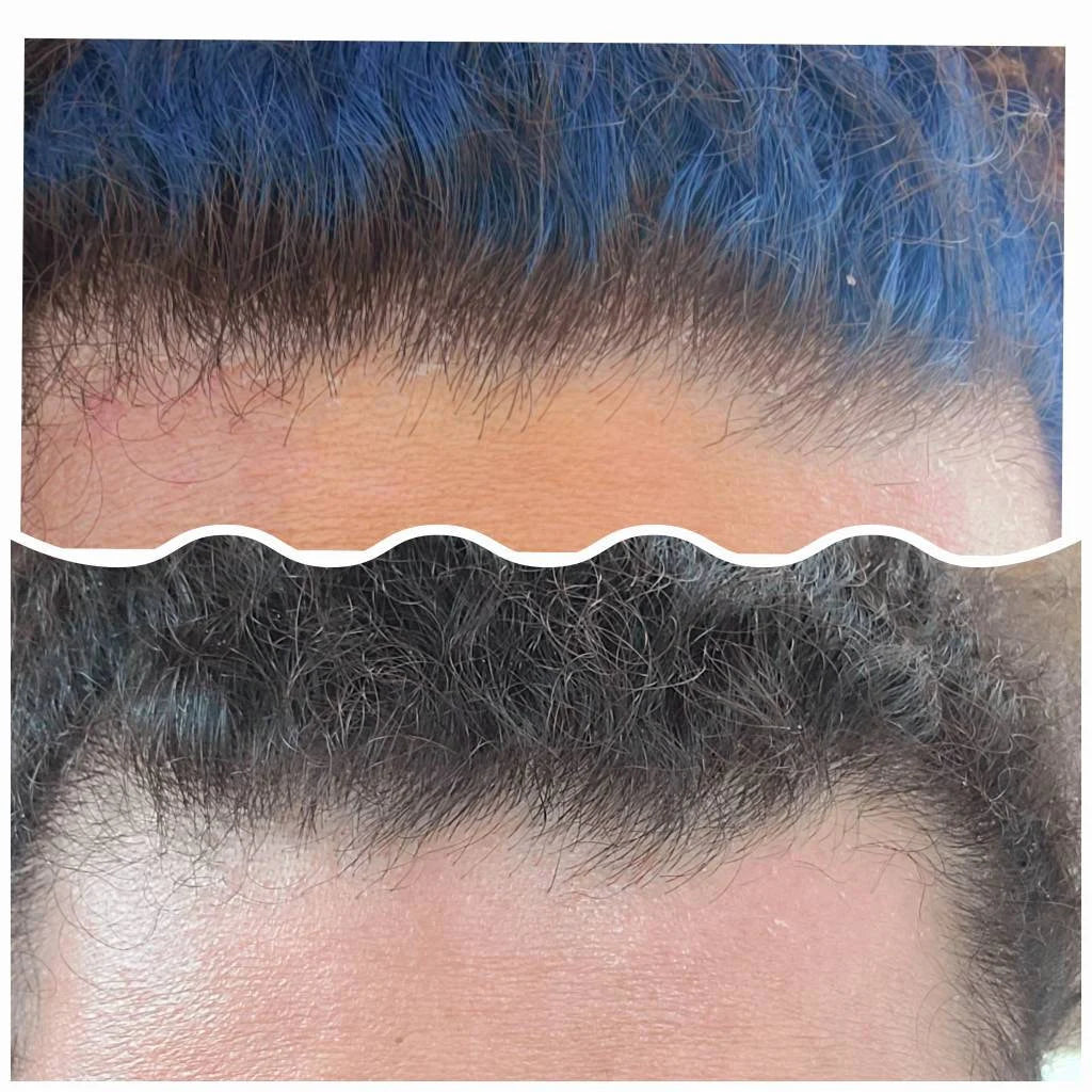 Dandruff/Build up detox shampoo