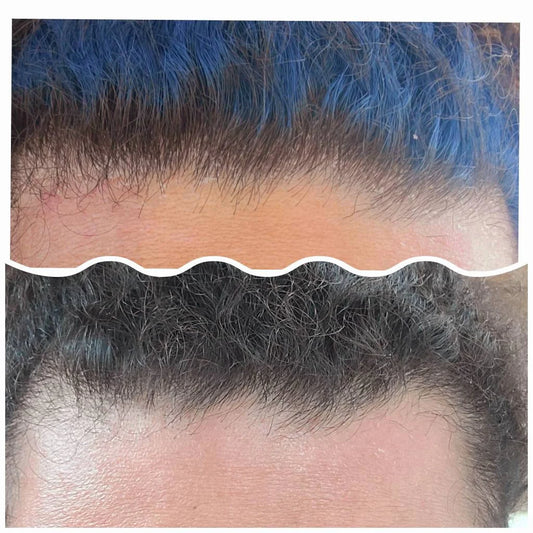 Dandruff/Build up detox shampoo