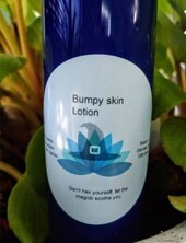 Eczema/rash lotion